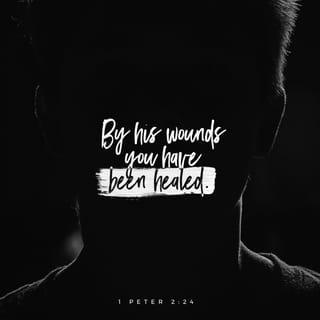 1 Peter 2:24 - and He Himself bore our sins in His body on the cross, so that we might die to sin and live to righteousness; for by His wounds you were healed.