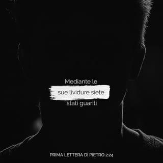 Prima lettera di Pietro 2:24 - egli ha portato i nostri peccati nel suo corpo, sul legno della croce, affinché, morti al peccato, vivessimo per la giustizia, e mediante le sue lividure siete stati guariti.