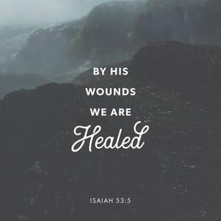 Isaiah 53:5 - But he was pierced for our transgressions,
he was crushed for our iniquities;
the punishment that brought us peace was on him,
and by his wounds we are healed.