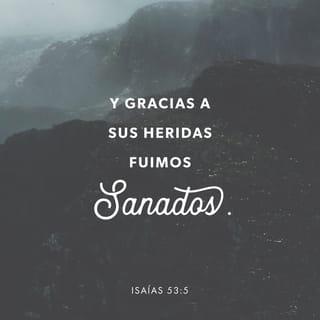 Isaías 53:5 - Mas Él fue herido por nuestras transgresiones,
molido por nuestras iniquidades.
El castigo, por nuestra paz, cayó sobre Él,
y por sus heridas hemos sido sanados.