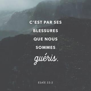 Ésaïe 53:4-5 - Pourtant, ce sont nos maladies qu’il supportait,
c’est de notre souffrance qu’il s’était chargé.
Et nous, nous pensions :
c’est Dieu qui le punit de cette façon,
c’est Dieu qui le frappe et l’abaisse.
Mais il était blessé à cause de nos fautes,
il était écrasé à cause de nos péchés.
La punition qui nous donne la paix
est tombée sur lui.
Et c’est par ses blessures
que nous sommes guéris.