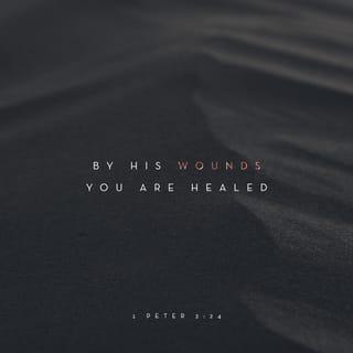 1 Peter 2:24 NCV