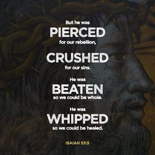 Isaiah 53:5 - But he was pierced for our transgressions,
he was crushed for our iniquities;
the punishment that brought us peace was on him,
and by his wounds we are healed.